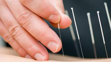 PCOM Proud to Play Role in IL. Dry Needling Legislation Victory