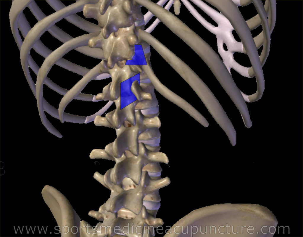 A Channel Perspective On Thoracolumbar Junction Syndrome Pacific College