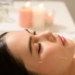 cosmetic acupuncture